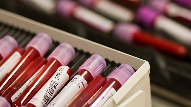 Doping volkanında Türkiye zirvede